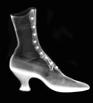 X-ray of a shoe